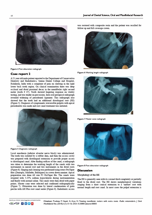 Journal of dental science, oral and maxillofacial research 2018.10.16.